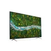 LG UP77 70 Inch 4K UHD Smart LED TV